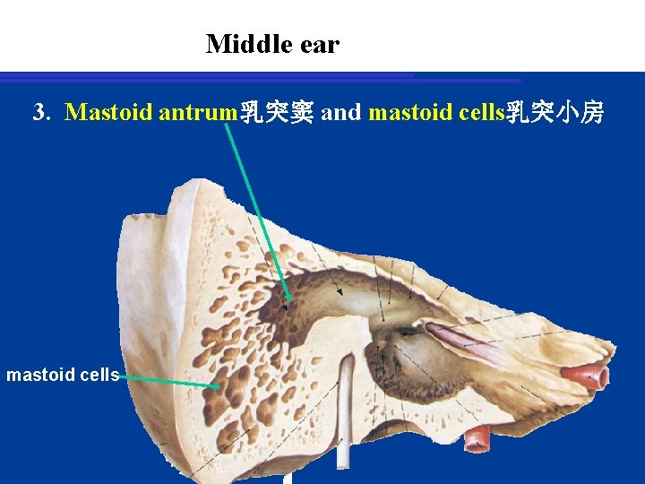 Middle ear 3. Mastoid antrum乳突窦 and mastoid cells乳突小房 mastoid cells 