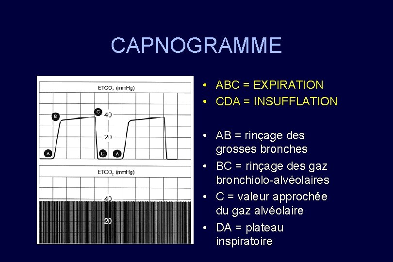 CAPNOGRAMME • ABC = EXPIRATION • CDA = INSUFFLATION • AB = rinçage des