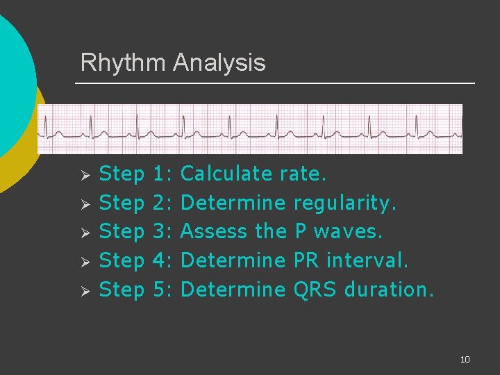 Rhythm Analysis Ø Ø Ø Step Step 1: Calculate rate. 2: Determine regularity. 3: