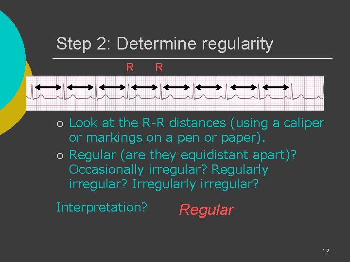 Step 2: Determine regularity R ¡ ¡ R Look at the R-R distances (using