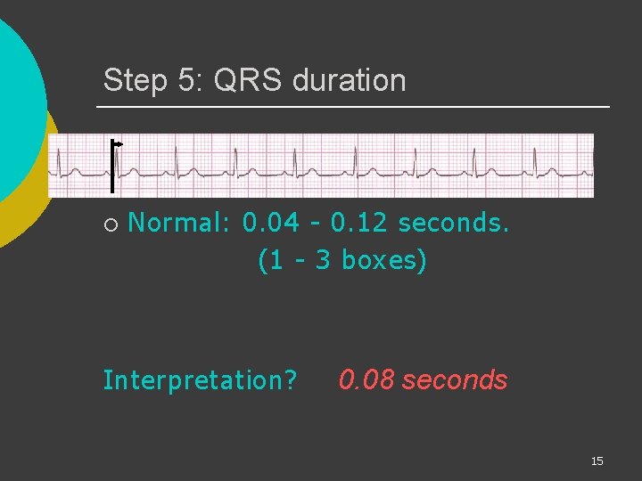 Step 5: QRS duration ¡ Normal: 0. 04 - 0. 12 seconds. (1 -