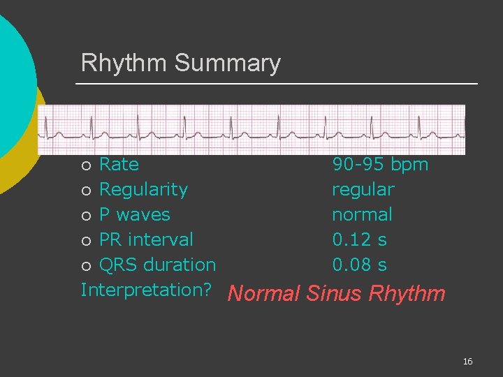 Rhythm Summary Rate ¡ Regularity ¡ P waves ¡ PR interval ¡ QRS duration