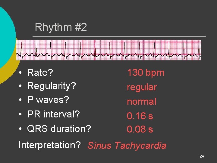 Rhythm #2 • • • Rate? Regularity? P waves? PR interval? QRS duration? 130
