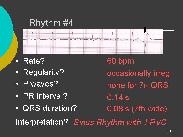 Rhythm #4 • • • Rate? Regularity? P waves? PR interval? QRS duration? 60