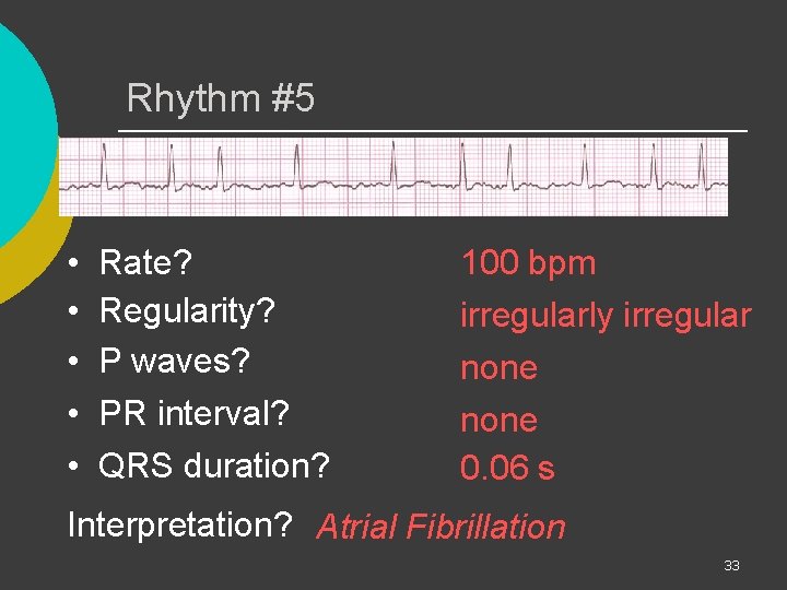 Rhythm #5 • • • Rate? Regularity? P waves? PR interval? QRS duration? 100