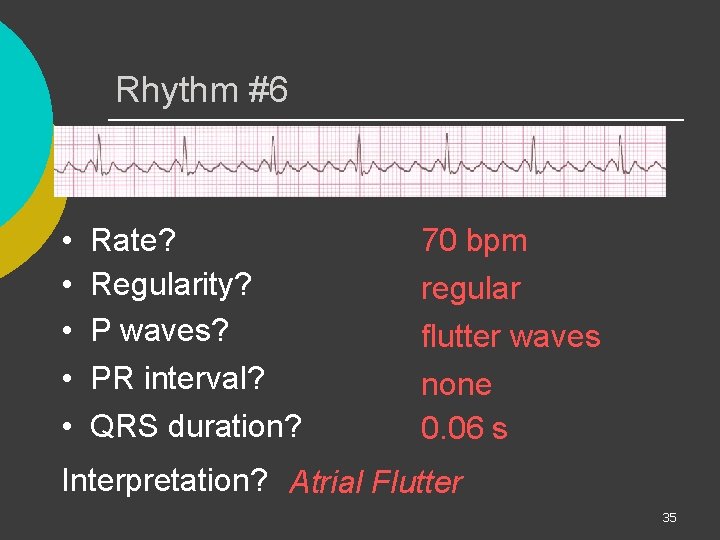 Rhythm #6 • • • Rate? Regularity? P waves? PR interval? QRS duration? 70