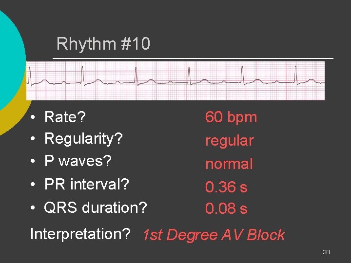 Rhythm #10 • • • Rate? Regularity? P waves? PR interval? QRS duration? 60