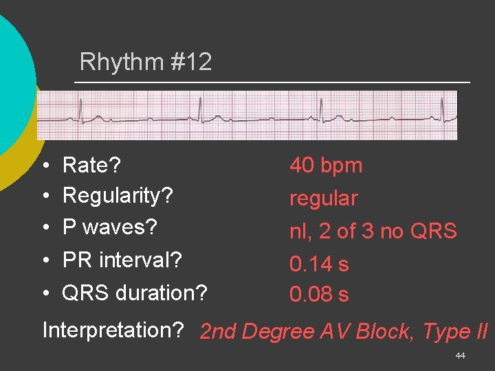 Rhythm #12 • • • Rate? Regularity? P waves? PR interval? QRS duration? 40