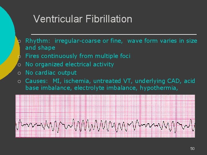 Ventricular Fibrillation ¡ ¡ ¡ Rhythm: irregular-coarse or fine, wave form varies in size