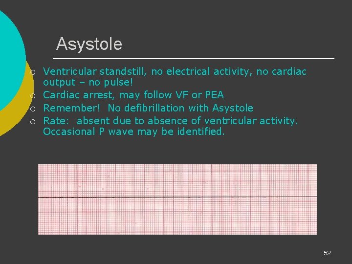 Asystole ¡ ¡ Ventricular standstill, no electrical activity, no cardiac output – no pulse!