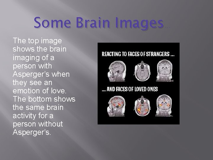 Some Brain Images… The top image shows the brain imaging of a person with