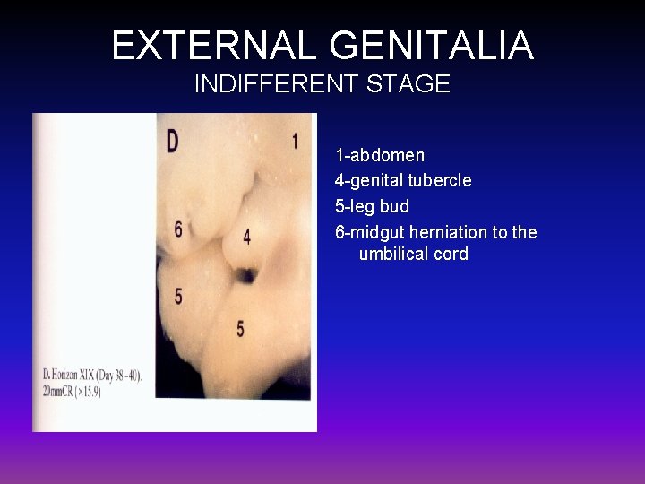 EXTERNAL GENITALIA INDIFFERENT STAGE 1 -abdomen 4 -genital tubercle 5 -leg bud 6 -midgut