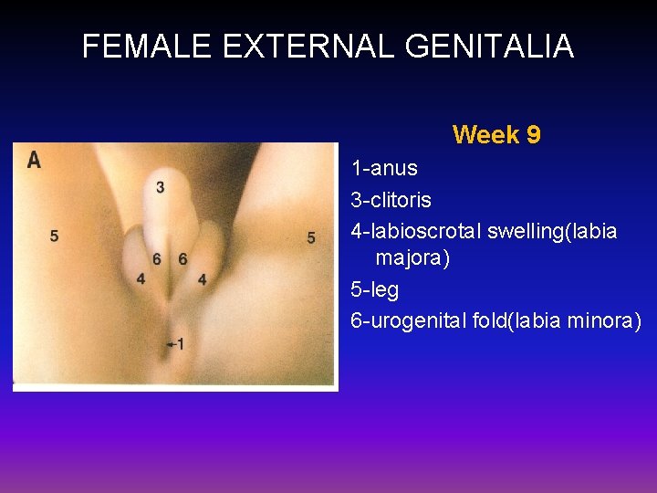 FEMALE EXTERNAL GENITALIA Week 9 1 -anus 3 -clitoris 4 -labioscrotal swelling(labia majora) 5