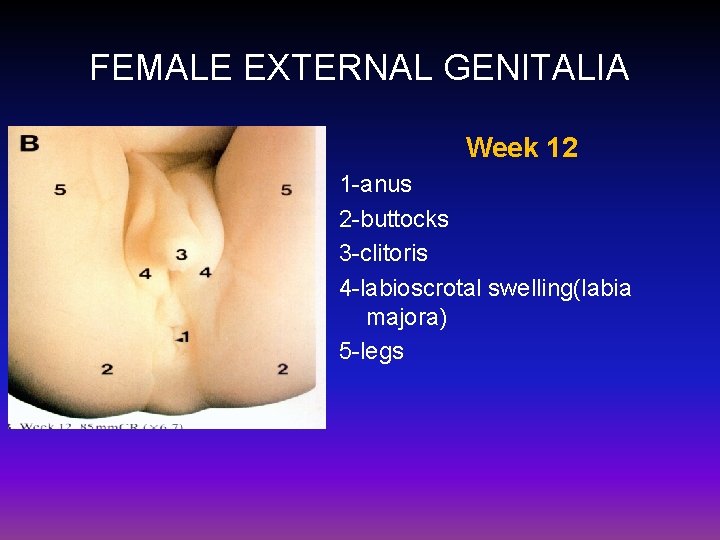 FEMALE EXTERNAL GENITALIA Week 12 1 -anus 2 -buttocks 3 -clitoris 4 -labioscrotal swelling(labia