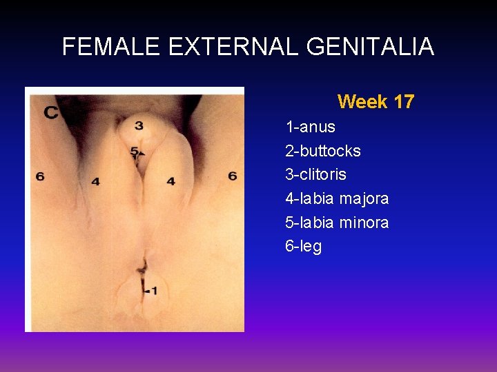 FEMALE EXTERNAL GENITALIA Week 17 1 -anus 2 -buttocks 3 -clitoris 4 -labia majora