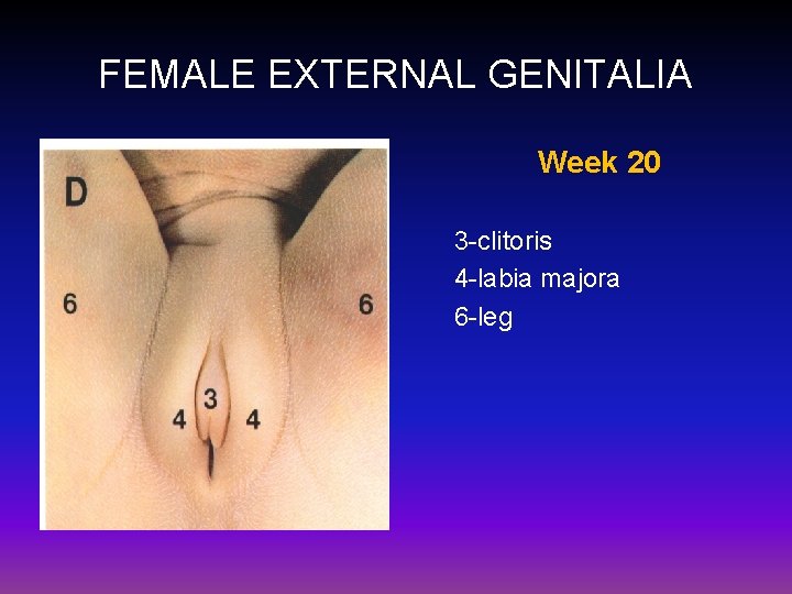 FEMALE EXTERNAL GENITALIA Week 20 3 -clitoris 4 -labia majora 6 -leg 