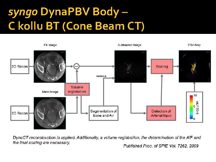 syngo Dyna. PBV Body – C kollu BT (Cone Beam CT) 