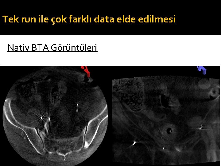 Tek run ile çok farklı data elde edilmesi Nativ BTA Görüntüleri 