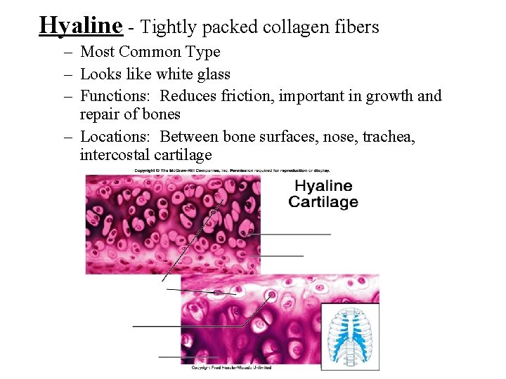 Hyaline - Tightly packed collagen fibers – Most Common Type – Looks like white