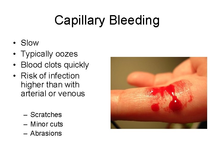 Capillary Bleeding • • Slow Typically oozes Blood clots quickly Risk of infection higher