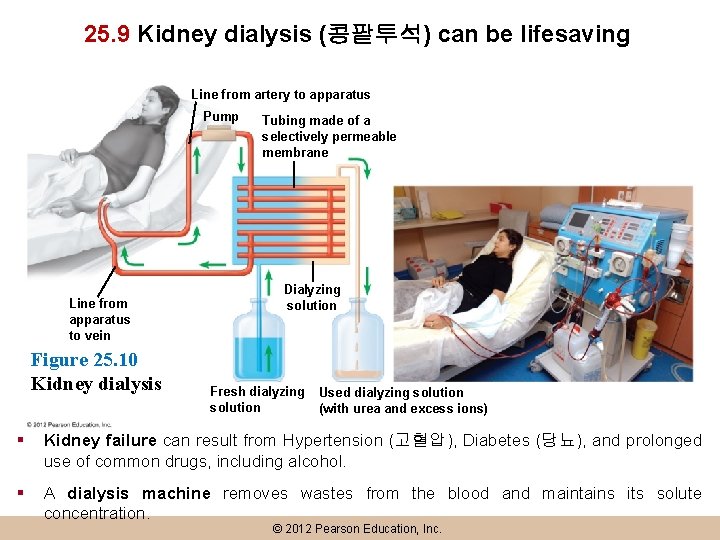 25. 9 Kidney dialysis (콩팥투석) can be lifesaving Line from artery to apparatus Pump
