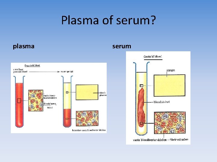 Plasma of serum? plasma serum 