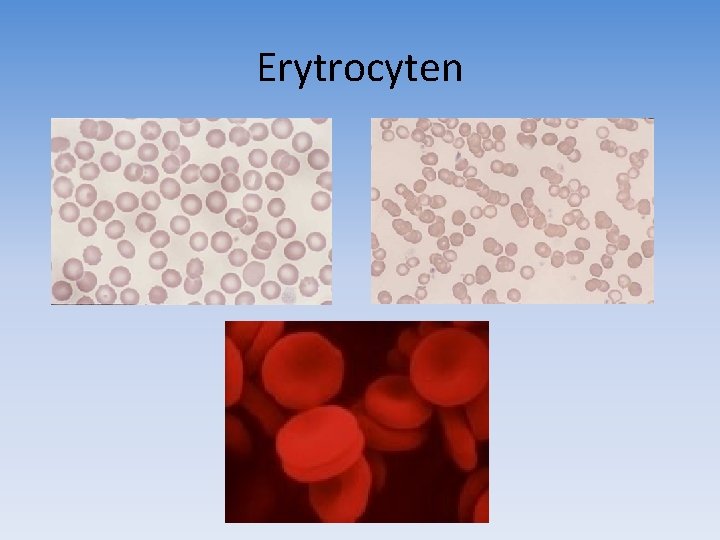 Erytrocyten 