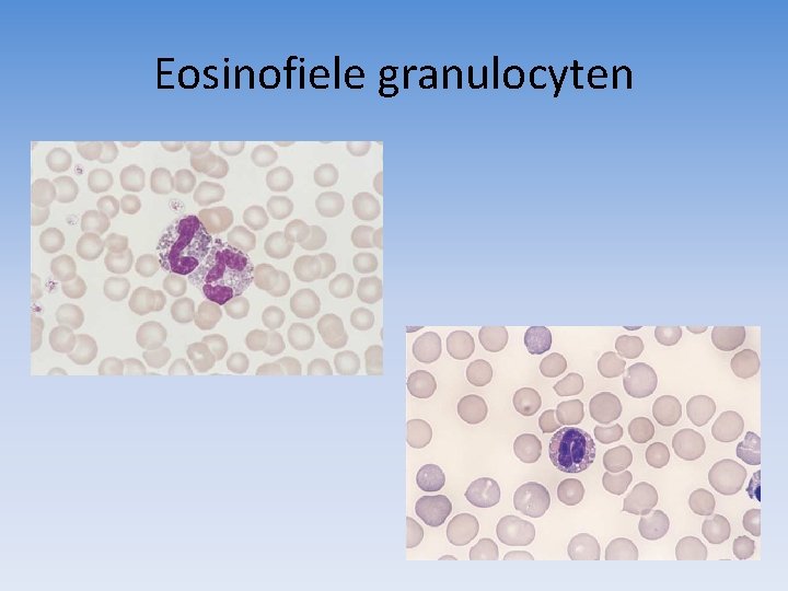 Eosinofiele granulocyten 