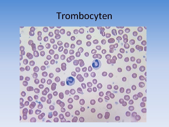 Trombocyten 