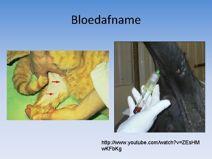 Bloedafname http: //www. youtube. com/watch? v=ZEs. HM w. KFb. Kg 