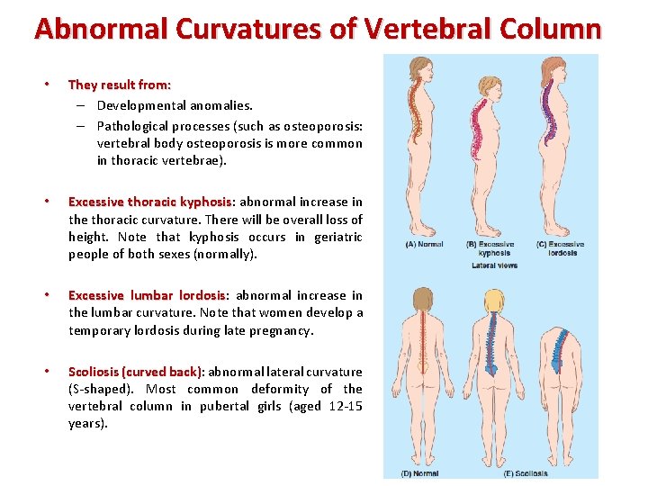 Abnormal Curvatures of Vertebral Column • They result from: – Developmental anomalies. – Pathological