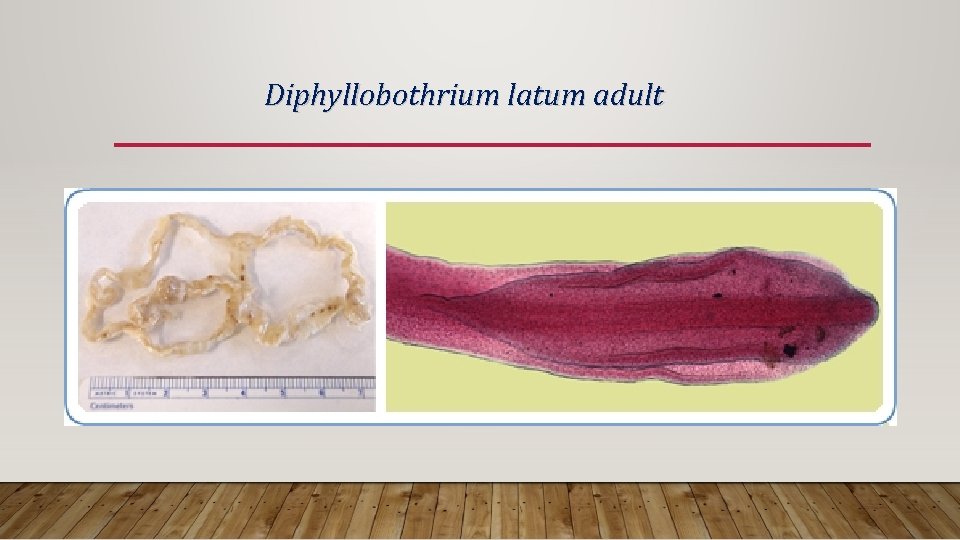 Diphyllobothrium latum adult 