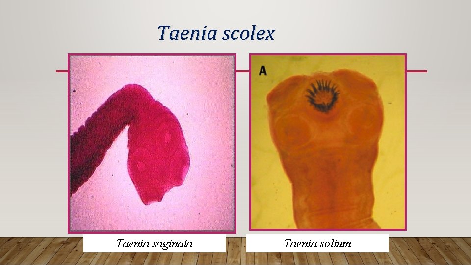Taenia scolex Taenia saginata Taenia solium 