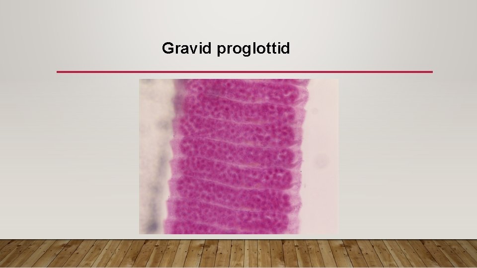 Gravid proglottid 