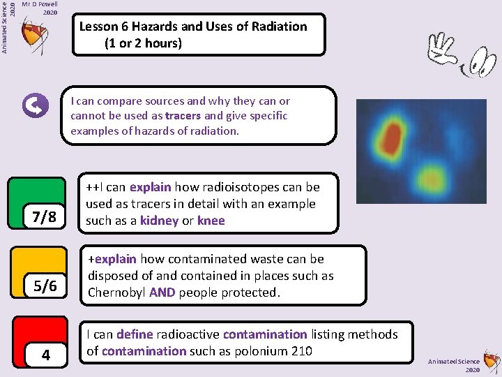 Animated Science 2020 Mr D Powell 2020 Lesson 6 Hazards and Uses of Radiation