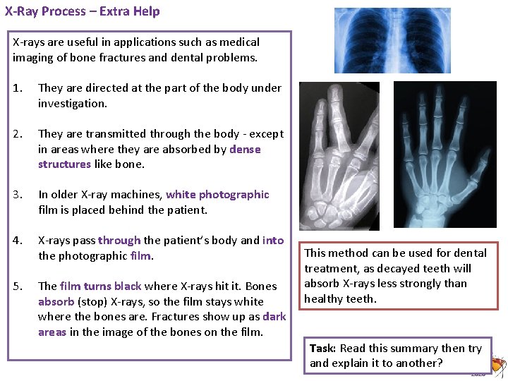 X-Ray Process – Extra Help X-rays are useful in applications such as medical imaging