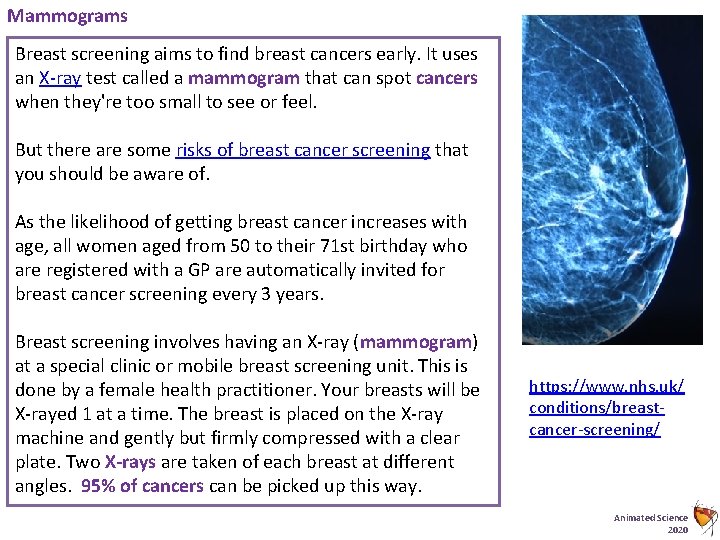 Mammograms Breast screening aims to find breast cancers early. It uses an X-ray test