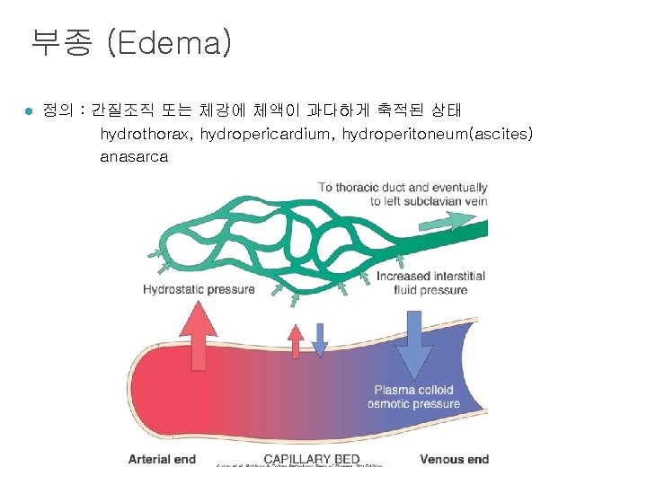 부종 (Edema) l 정의 : 간질조직 또는 체강에 체액이 과다하게 축적된 상태 hydrothorax, hydropericardium,