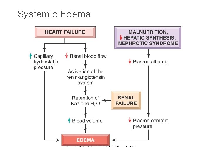 Systemic Edema 