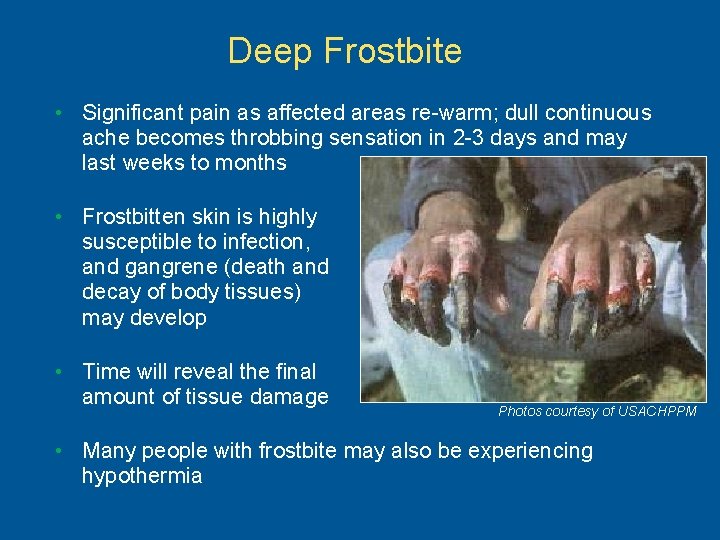 Deep Frostbite • Significant pain as affected areas re-warm; dull continuous ache becomes throbbing