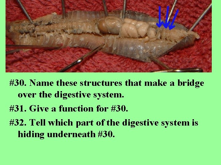 #30. Name these structures that make a bridge over the digestive system. #31. Give