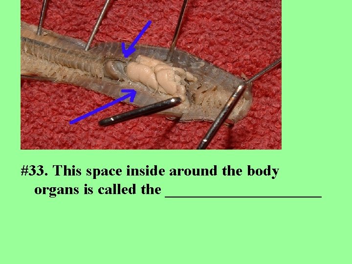 #33. This space inside around the body organs is called the __________ 