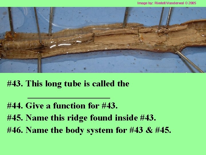 Image by: Riedell/Vanderwal © 2005 #43. This long tube is called the _________ #44.