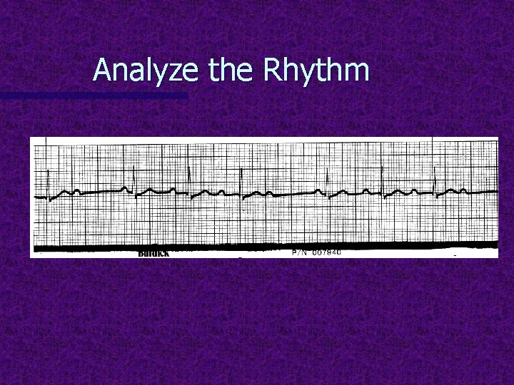 Analyze the Rhythm 