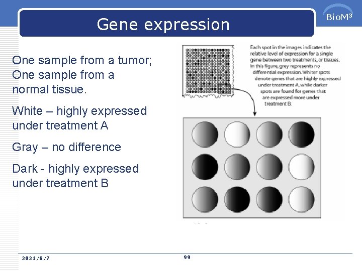 Gene expression One sample from a tumor; One sample from a normal tissue. White