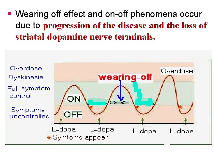 § Wearing off effect and on-off phenomena occur due to progression of the disease