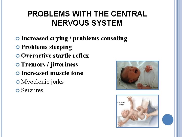 PROBLEMS WITH THE CENTRAL NERVOUS SYSTEM Increased crying / problems consoling Problems sleeping Overactive