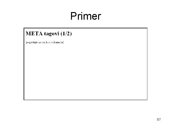 Primer 87 Primer 87