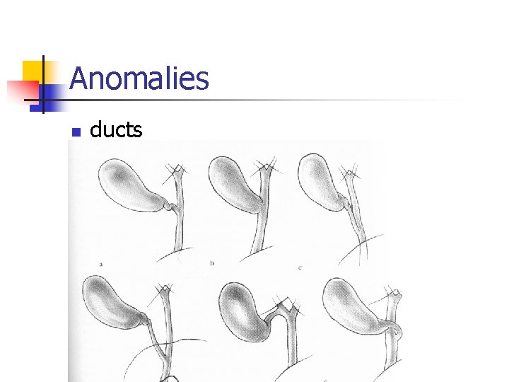 Anomalies n ducts 