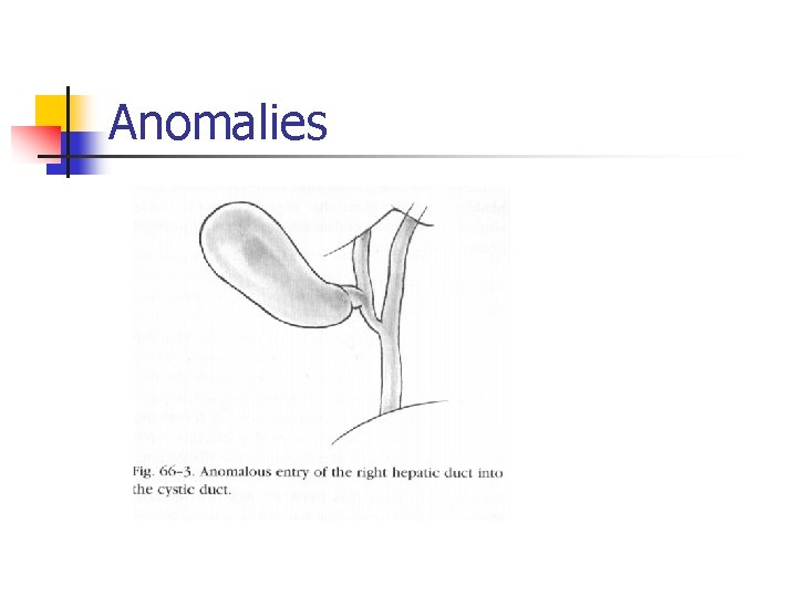 Anomalies 